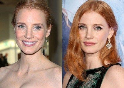 jessica chastain plastic surgery|Jessica Chastain on Getting Plastic Surgery: Who。